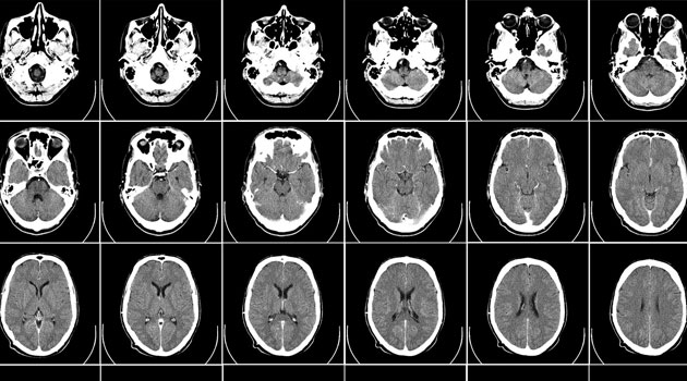 ¿Es verdad aquello de que estamos usando sólo una pequeña parte de nuestro cerebro?